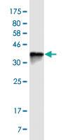 Anti-MUC7 Mouse Monoclonal Antibody [clone: 7F2]