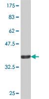 Anti-AK4 Mouse Polyclonal Antibody