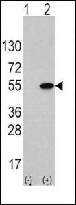 Anti-ATF4 Rabbit Polyclonal Antibody (HRP (Horseradish Peroxidase))