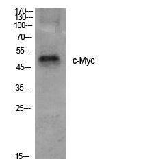 Western blot analysis of various cells using Anti-MYC Antibody