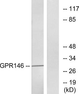 Western blot analysis of lysates from LOVO cells using Anti-GPR146 Antibody The right hand lane represents a negative control, where the antibody is blocked by the immunising peptide