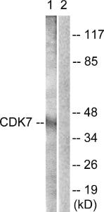 Western blot analysis of lysates from Raw264.7 cells, treated with Calyculin A 50 ng/ml 30' using Anti-CDK7 Antibody. The right hand lane represents a negative control, where the antibody is blocked by the immunising peptide