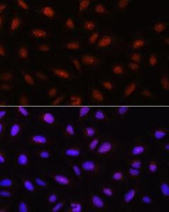 Immunofluorescence analysis of U-2 OS cells using Anti-AKT1 + AKT2 + AKT3 Antibody (A306139) at a dilution of 1:100. DAPI was used to stain the cell nuclei (blue)