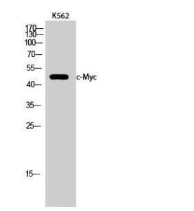 Western blot analysis of K562 cells using Anti-MYC Antibody