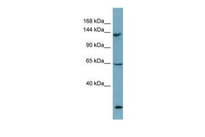 Anti-LATS1 Rabbit Polyclonal Antibody