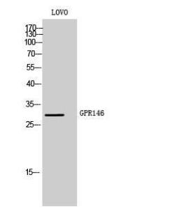 Western blot analysis of LOVO cells using Anti-GPR146 Antibody