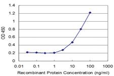 Anti-SAFB2 Mouse Monoclonal Antibody [clone: 4H3]