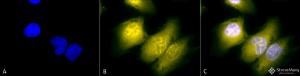 Immunocytochemistry/Immunofluorescence analysis of human heat shocked cervical cancer cell line (HeLa), fixed in 2% formaldehyde for 20 minutes at room temperature, using Anti-GRP78 Antibody (A305023), at 1:60 for 12 hours at 4°C