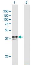 Anti-SLC29A1 Mouse Polyclonal Antibody