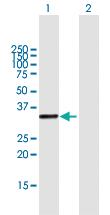 Anti-UVSSA Mouse Polyclonal Antibody