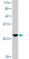 Anti-DDX56 Mouse Monoclonal Antibody [clone: 6B9]