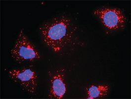 Anti-FGFR2 + PLCG1 Antibody Pair