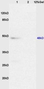 Anti-CASP8 Rabbit Polyclonal Antibody