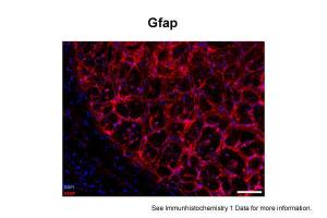 Anti-GFAP Rabbit Polyclonal Antibody