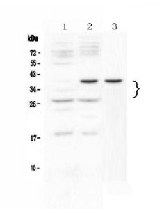 Anti-VEGF Polyclonal Antibody