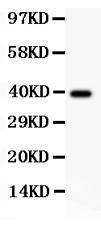 Anti-Collagen III Polyclonal Antibody