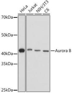 Western blot analysis of extracts of various cell lines, using Anti-Aurora B Antibody (A92918) at 1:1000 dilution