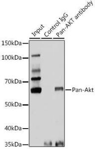 Immunoprecipitation analysis of 25 µg extracts of rat brain cells using 3 µg of Anti-AKT1 + AKT2 + AKT3 Antibody (A306139). This Western blot was performed on the immunoprecipitate using Anti-AKT1 + AKT2 + AKT3 Antibody (A306139) at a dilution of 1:1000