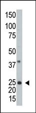 Anti-ARL3 Rabbit Polyclonal Antibody