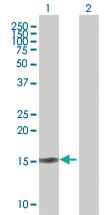 Anti-SCGB2A2 Mouse Polyclonal Antibody