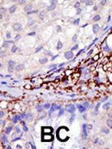 Anti-RNF216 Rabbit Polyclonal Antibody (AP (Alkaline Phosphatase))