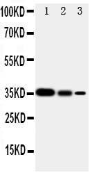 Anti-Smad2 Rabbit Polyclonal Antibody