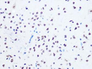 Immunohistochemistry analysis of paraffin-embedded rat brain using Anti-Ogg1 Antibody [ARC1233] (A309056) at a dilution of 1:100 (40X lens). Perform microwave antigen retrieval with 10 mM PBS buffer pH 7.2 before commencing with IHC staining protocol