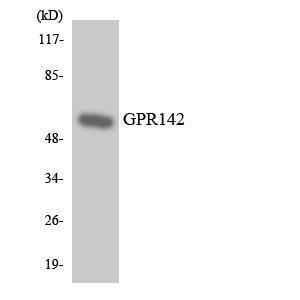 Anti-GPR142 Rabbit Polyclonal Antibody