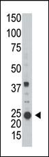 Anti-ARL3 Rabbit Polyclonal Antibody