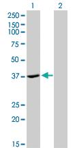 Anti-ADH4 Mouse Monoclonal Antibody [clone: 3C5]