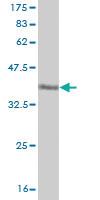 Anti-TLR7 Mouse Monoclonal Antibody [clone: 3G6]