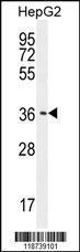 Anti-CNOT7 Rabbit Polyclonal Antibody (HRP (Horseradish Peroxidase))