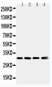 Anti-Superoxide Dismutase 3 Rabbit Polyclonal Antibody