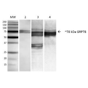 Western blot analysis of Human, mouse, rat NIH3T3, rat Brain, and HEK-293 cell lysates showing detection of ~78 kDa GRP78 protein using Anti-GRP78 Antibody [3C5-1A4] (A305024) at 1:1,000 for 1 hour at room temperature