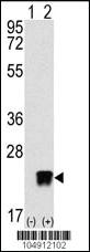 Anti-ARL3 Rabbit Polyclonal Antibody