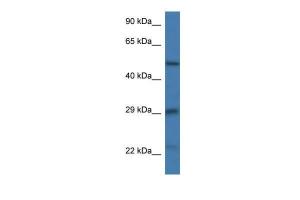 Anti-GFAP Rabbit Polyclonal Antibody