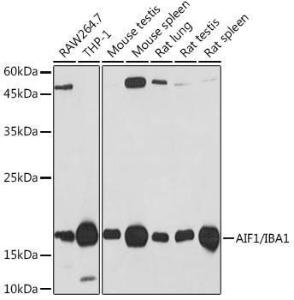 Western blot analysis of extracts of various cell lines, using Anti-Iba1 Antibody [ARC2301] (A307823) at 1:1,000 dilution. The secondary antibody was Goat Anti-Rabbit IgG H&L Antibody (HRP) at 1:10,000 dilution.