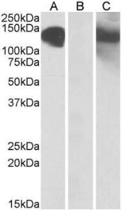 HEK293 lysate (10ug protein in RIPA buffer) overexpressing Human CDH11 with C-ter minal MYC tag probed with Anti-CDH11 Antibody (A84823) (1 µg/ml) in Lane A and probed with anti-MYC Tag (1/1000) in lane C