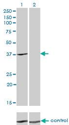 Anti-ADH4 Mouse Monoclonal Antibody [clone: 3C5]