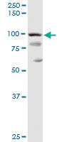 Anti-PDCD6IP Rabbit Polyclonal Antibody