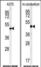 Anti-CACUL1 Rabbit Polyclonal Antibody (AP (Alkaline Phosphatase))