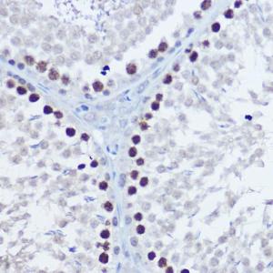 Immunohistochemistry analysis of paraffin-embedded rat testis using Anti-Aurora B Antibody (A92918) at a dilution of 1:100 (40x lens). Perform high pressure antigen retrieval with 10 mM citrate buffer pH 6.0 before commencing with IHC staining protocol