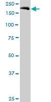 Anti-EIF5B Mouse Polyclonal Antibody