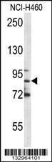 Anti-MPO Rabbit Polyclonal Antibody