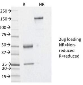 SDS-PAGE analysis of Anti-YB1 Antibody [YBX1/2430] under non-reduced and reduced conditions; showing intact IgG and intact heavy and light chains, respectively. SDS-PAGE analysis confirms the integrity and purity of the antibody.