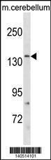 Anti-GRIN2C Rabbit Polyclonal Antibody (AP (Alkaline Phosphatase))