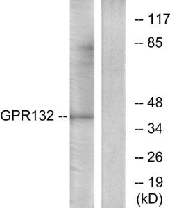 Western blot analysis of lysates from Jurkat cells using Anti-GPR132 Antibody. The right hand lane represents a negative control, where the antibody is blocked by the immunising peptide