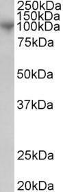 Antibody anti-ADAM8 100 µg