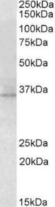 Anti-RDH5 Antibody (A84825) (2 µg/ml) staining of Mouse Eye lysate (35 µg protein in RIPA buffer). Primary incubation was 1 hour. Detected by chemiluminescence