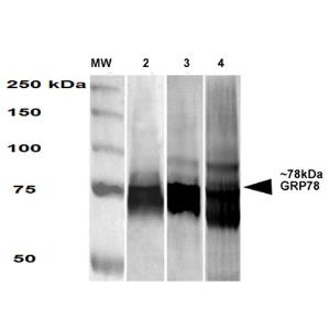 Western blot analysis of Human, mouse, rat HEK-293, NIH3T3, and rat brain cell lysates showing detection of GRP78 protein using Anti-GRP78 Antibody [3G12-1G11] (A305025) at 1:1,000